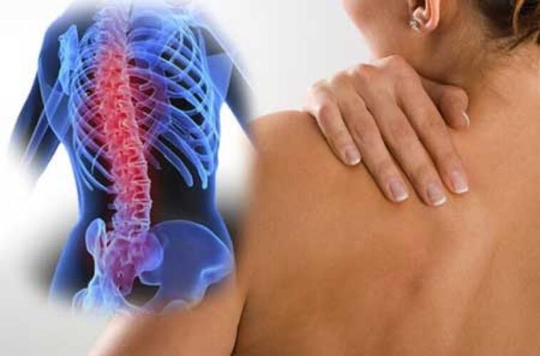 During exacerbation of osteochondrosis of the thoracic spine, dorsago pain occurs