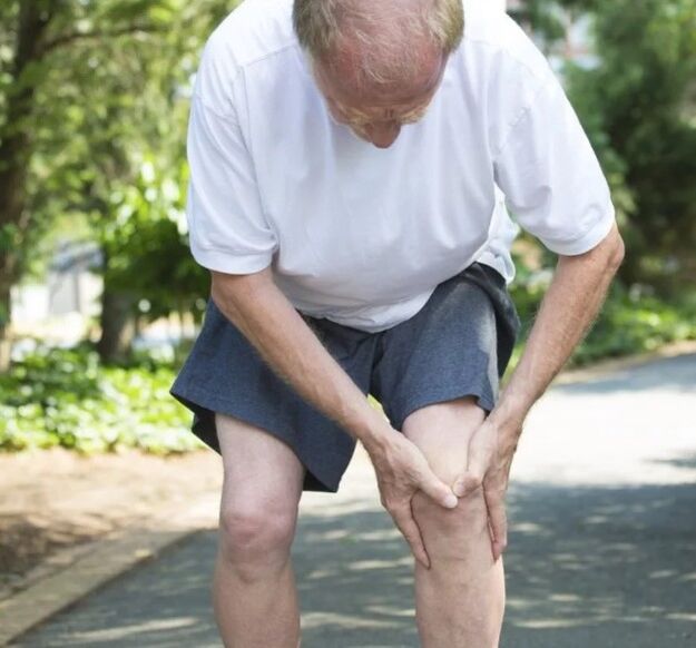 People exposed to arthrosis
