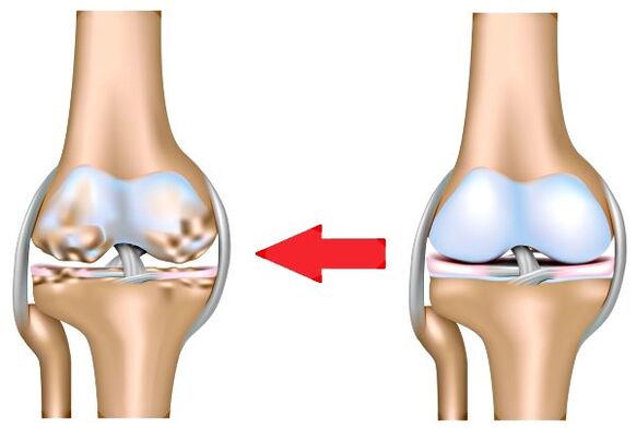 Together and healthy arthrosis