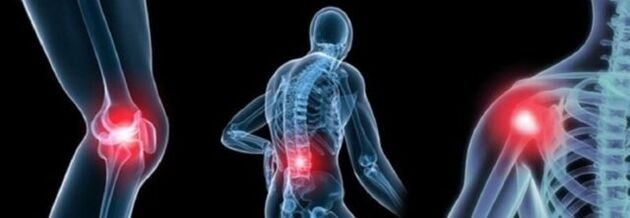 Type of pain with arthrosis