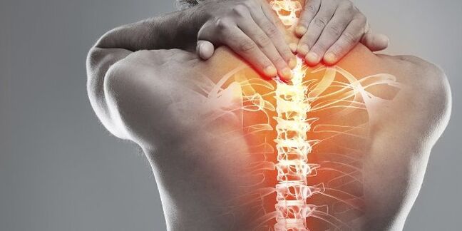 Medical options for cervical osteochondrosis therapy