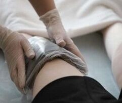Application of Ozokerite on the knee for Arthrosis