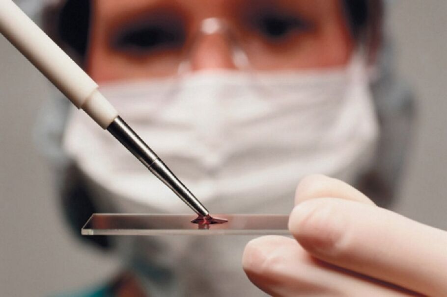 Arthritis is an inflammatory disease, and its presence is revealed through a blood test.