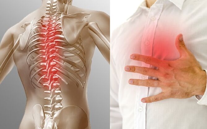 Thoracic osteochondrosis is indicated by pain and tightness in the chest